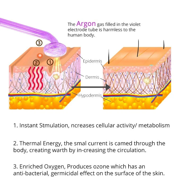 "Revitalize Your Skin with the Abay Apparatus High Frequency Facial Machine - the Ultimate Electrotherapy Wand for Hair, Face, and Acne Treatment!"